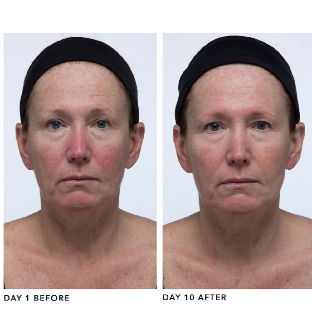 ❌️SOLD❌ *SEALED* Algenist Genius Sleeping Collagen Night Cream Moisturizer - Picture 10 of 11